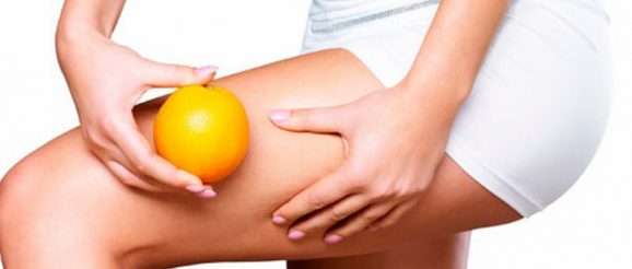 Cellulite Cause E Rimedi Retehphitalia It Blog Di Salute E Benessere